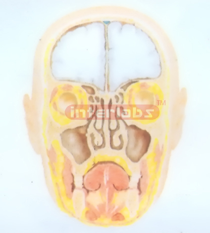 HUMAN PARANASAL SINUSES MODEL